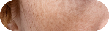 Condition indicator